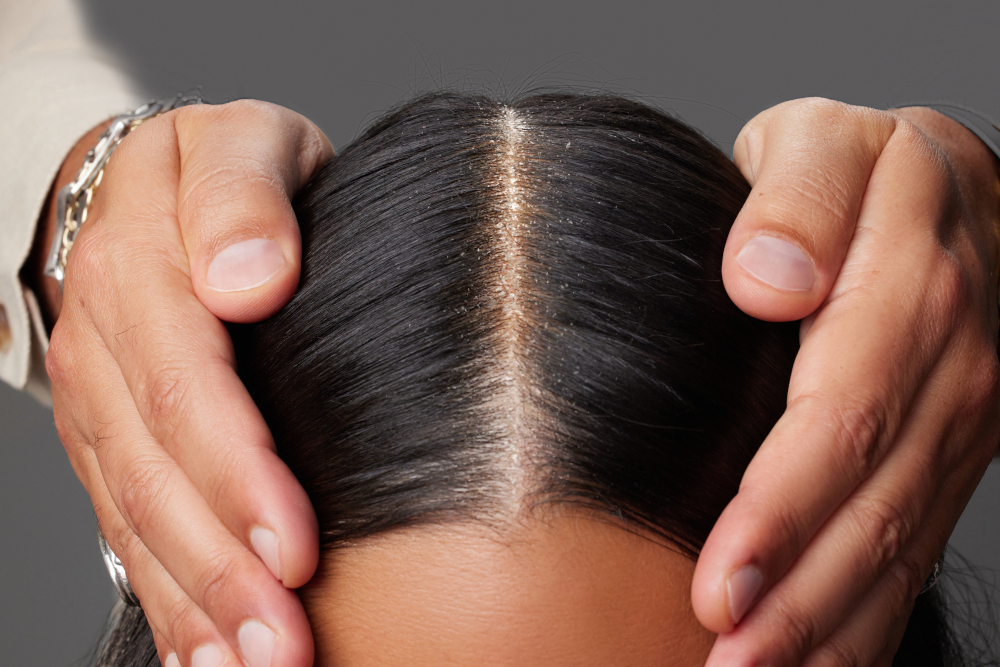 hair before treatment